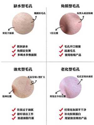 毛孔粗大怎么改善,毛孔粗大怎么根治永久不复发