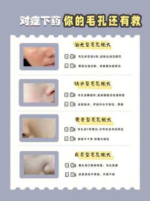 毛孔粗怎么解决（面部毛孔粗怎么解决）