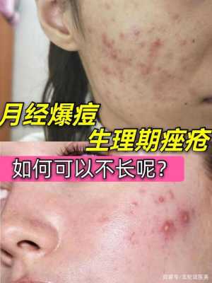 女生为什么会长痘痘（女生说最近长了好多痘怎么回）