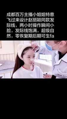怎么恢复发际线（发际线过高自救方法）
