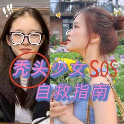 怎么恢复发际线（发际线过高自救方法）