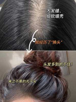 头发掉的太多怎么办（家里面头发掉的太多怎么办）