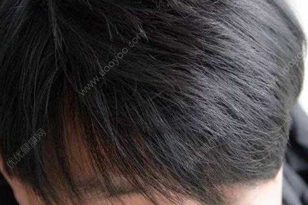 小孩头发油怎么办（16岁男生头发老出油怎么办）
