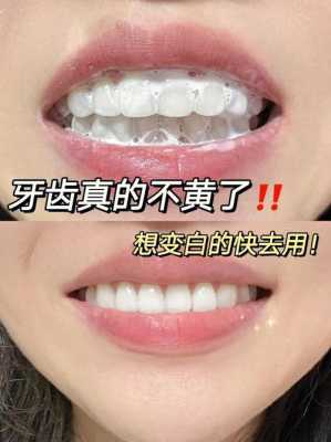 牙齿越来越黄怎么办（牙齿越来越黄怎么办小妙招）