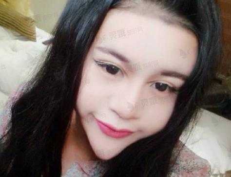 什么叫锥子脸,锥子脸什么样的