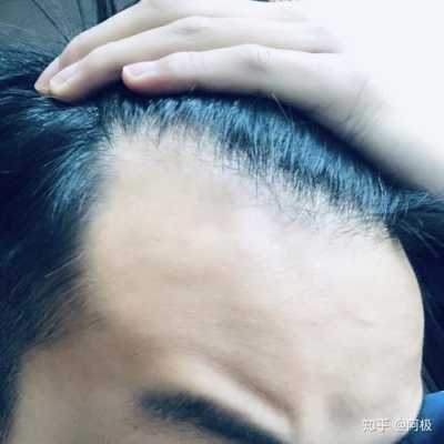 发际线有个尖。有什么说法,什么是尖额头发型