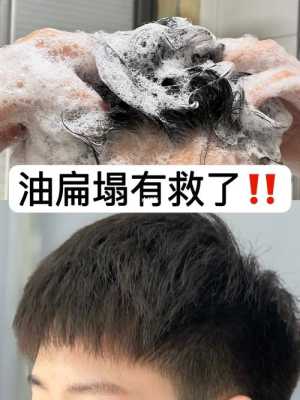 男生头发油腻怎么办（男士头发爱出油怎么办）