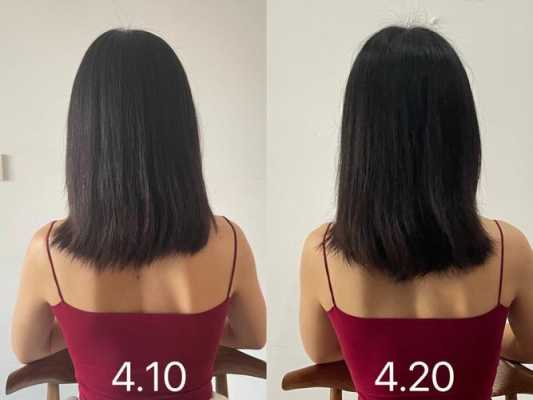 头发光掉不长怎么办,头发掉了不长怎么办我很着急