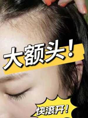 头发少发际线高怎么办（脑门秃发际线高怎么办）