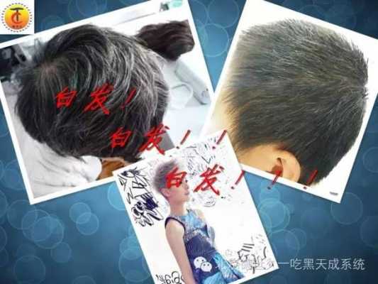 为什么会生白头发（为什么会生白头发的原因）