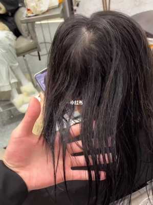 发量特别少怎么办（发量好少怎么办）