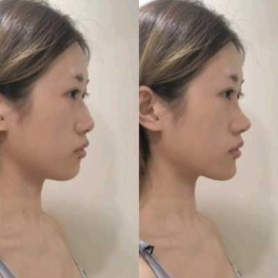 为什么体瘦的人脸宽,脸宽是为什么女生