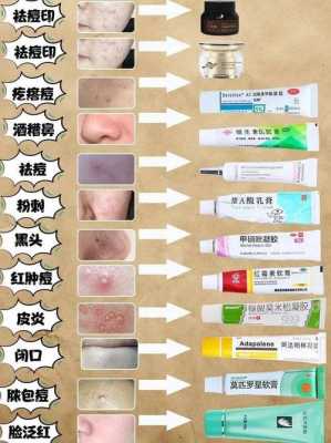 怎么除去痘痘（怎么除去痘痘印）