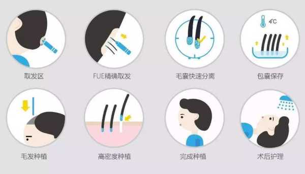 种头发是什么（种头发是什么原理）