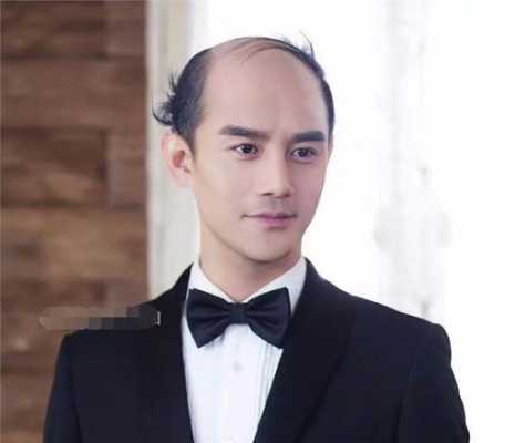 头发秃顶戴帽子好吗,头顶脱发适合什么发型男