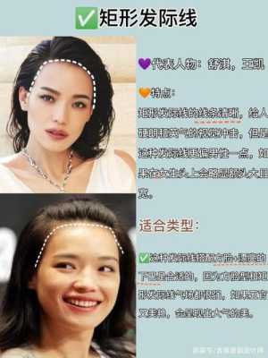 发际线是什么位置（发际线是什么位置图片）