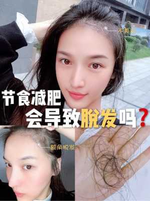 节食减肥脱发怎么办（过度节食减肥营养不良，会导致掉头发严重吗）