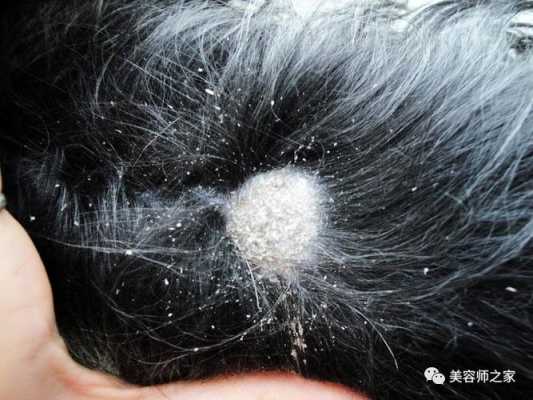染发后头皮痒怎么回事,洗完头头皮痒怎么回事,一挠头就痒