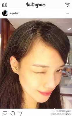 怎样去除脸上的白头,怎么去除白头发