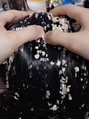 有什么办法去头皮屑（头皮屑多怎么洗）