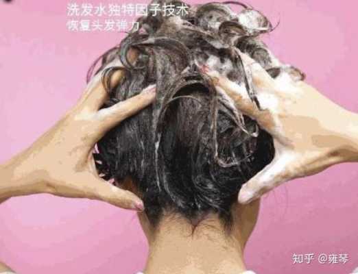 有什么办法去头皮屑（头皮屑多怎么洗）