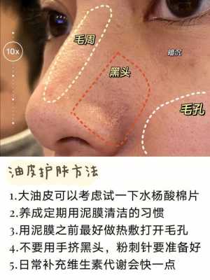 去黑头有什么好办法（去黑头有什么好办法吗）