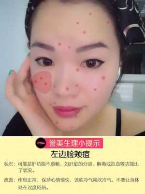 脸上长粉刺痘痘要怎么处理,脸上长粉刺了怎么办怎么去了