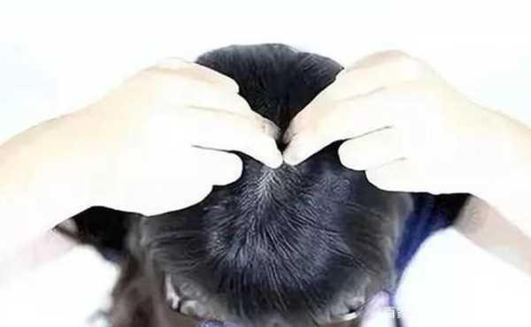 头发怎么生发最快,怎么样快速生发小妙招