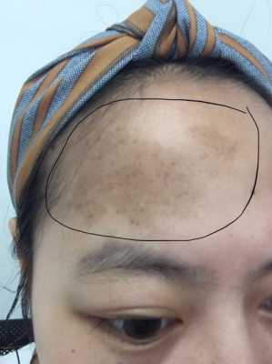 什么是大额头（大额头东北话啥意思）