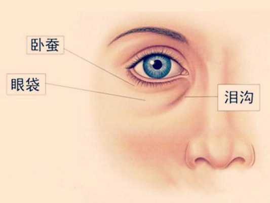 眼袋怎么形成的,眼袋是什么形成的图片