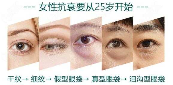 眼袋怎么形成的,眼袋是什么形成的图片