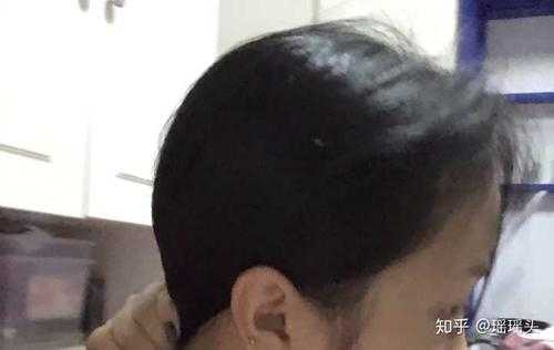 头型怎么看（怎么看自己的头型是圆还是瘪）