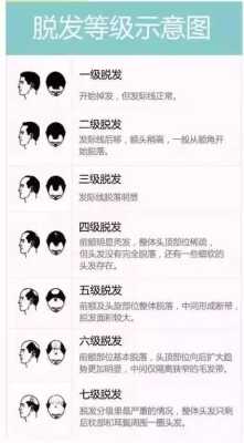 中年脱发怎么治疗（〓我舅舅，爸爸都中年脱发，我以后脱发的几率有多大？如何养发）