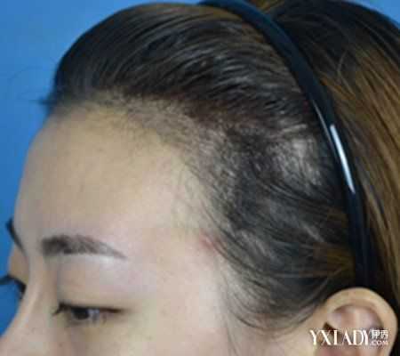 纹头发效果怎么样（纹头发效果怎么样 图片）