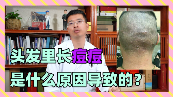头发长痘痘是什么原因（头发里长痘痘是什么原因）