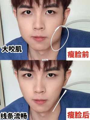 怎么变v型脸（怎么变v型脸13男）