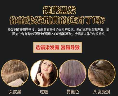 有什么办法让头发变黑（有什么办法让头发变黑不用染发剂）