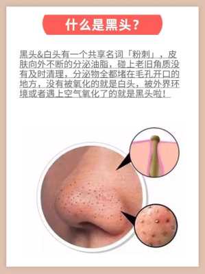 大黑头怎么办（收缩毛孔粗大黑头怎么办）