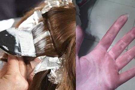 染发剂弄到手上怎么洗掉妙招,染发剂弄到手上怎么办小妙招