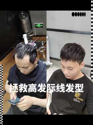发际线超高怎么办,发线高怎么办男孩