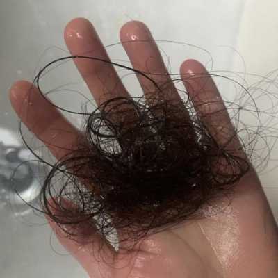 洗头时掉头发怎么办（洗头时掉头发怎么办女性）