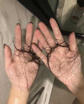 洗头时掉头发怎么办（洗头时掉头发怎么办女性）