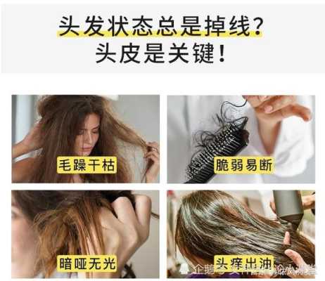 洗头时掉头发怎么办（洗头时掉头发怎么办女性）