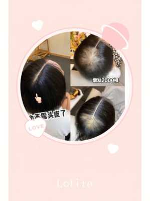 女生说她头发少该怎么安慰,小孩子头发稀少怎么办要吃什么