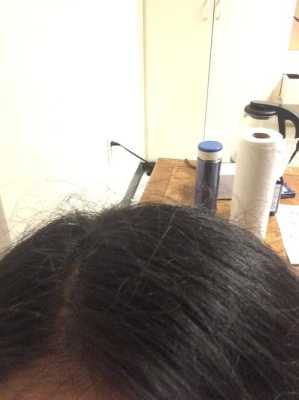 头顶的碎发断发很多，全翘在头顶，看着头发乱糟糟的，有什么解决方法吗,头发断的很厉害怎么办