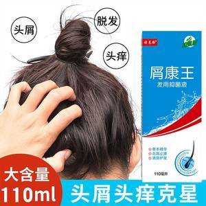 怎么治头皮屑最有效（请问去头屑用什么药最好）