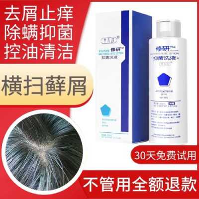 怎么治头皮屑最有效（请问去头屑用什么药最好）