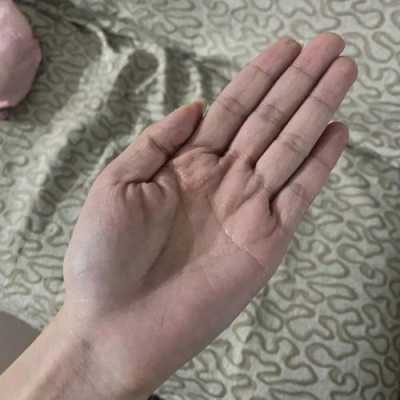 头发容易油，如果经常染发的话，会不会改善,头发太容易油怎么办女生
