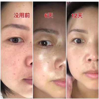 美白祛斑的最好方法,怎么美白和祛斑的方法
