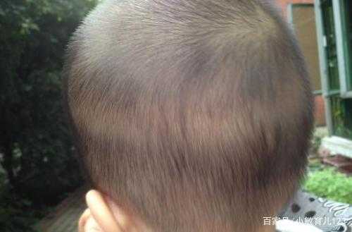 头发硬说明什么（婴儿头发硬说明什么）